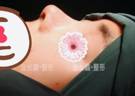 西京医院做鼻子做得好的大夫是哪个？