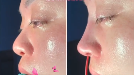廖连平和贾德渊哪个做鼻修复技术更好？