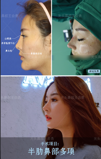 2022年上海肋骨鼻专家预约最多的是谁？
