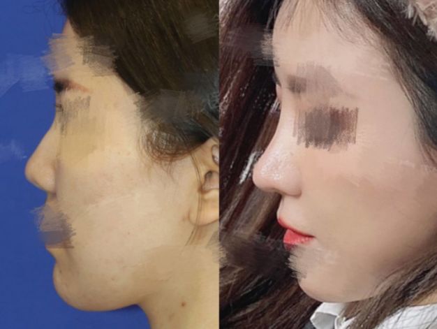 2023年北京最有名的鼻修复专家有哪些？