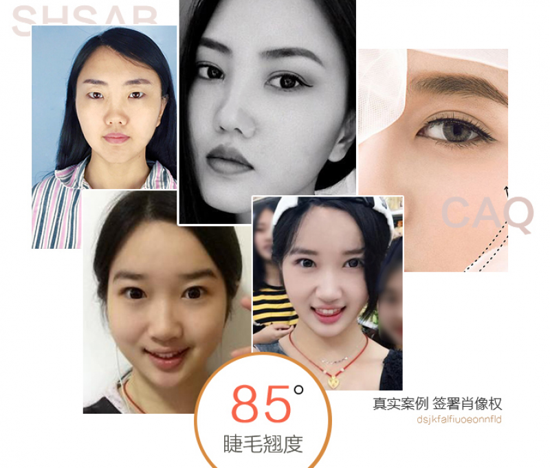 北京哪个医生做双眼皮比较自然点，价位多少？