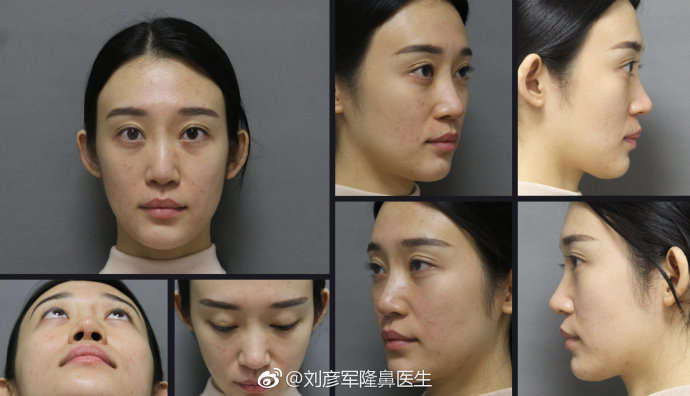 北京鼻修复好的专家有哪些？北京做鼻子修复最好的专家排名