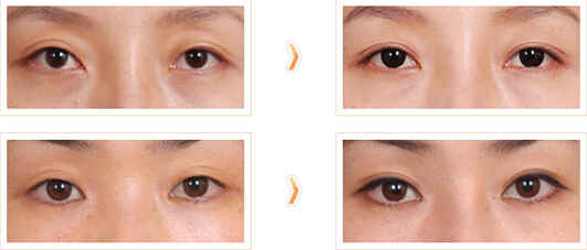 中国最好的双眼皮眼部整形修复专家：王振军（简介、案例、预约）