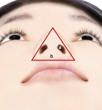 玻尿酸隆鼻不能不说的秘密：鼻子的黄金角度是什么?