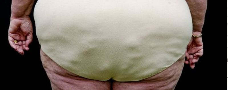 【抽脂百科】女人的脂肪为何比男人多？揭开不愿面对的秘密