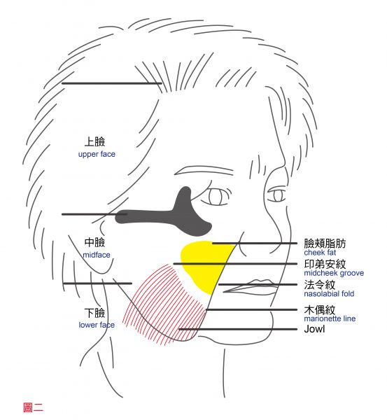 面部年轻化（拉皮手术）有哪几种分类？筋膜下拉皮和骨膜下拉皮一样吗？