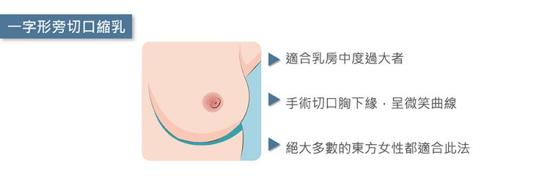 平胸、缩胸有哪些手术方式？平胸、缩胸手术切口详解