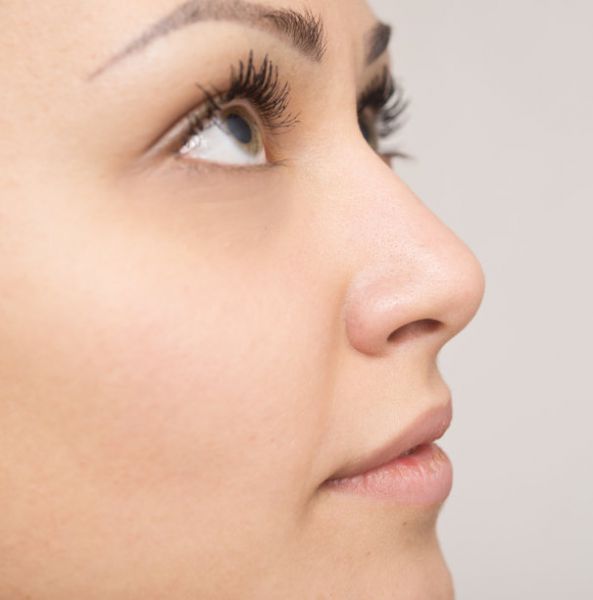 鼻头鼻翼鼻孔整形详解 隆鼻手术最好多大年龄做？