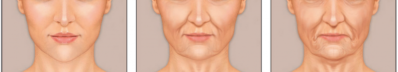 脸部下垂有什么面部提升方法吗？中脸下脸拉皮