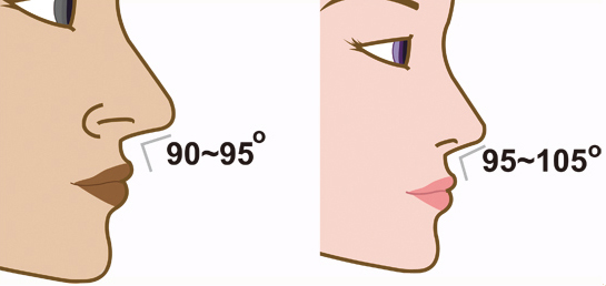 怎么判断鼻型是否合乎黄金比例标准评估？