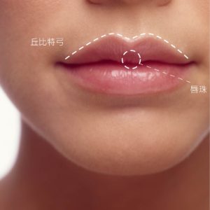 拉起完美的丘比特弓 上唇线手术效果怎么样？