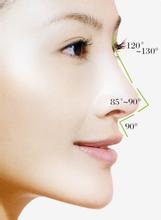 鼻部整形专家分析隆鼻失败修复